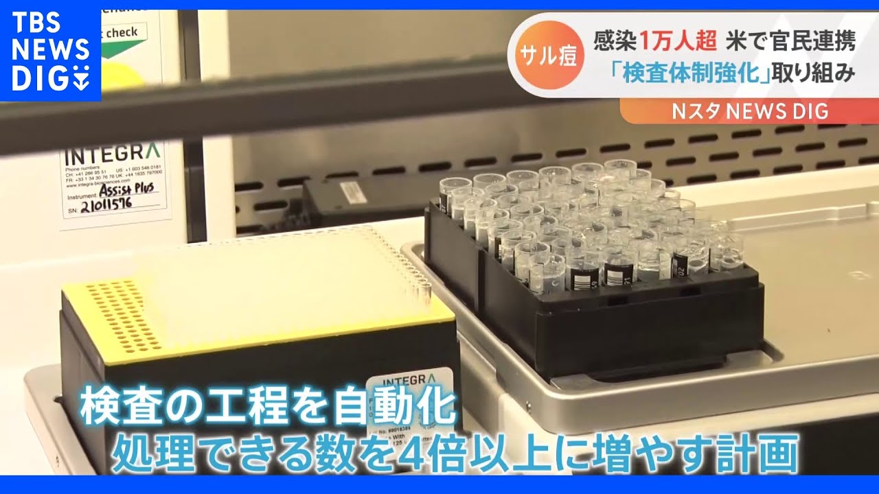 サル痘非常事態宣言のカリフォルニア　検査拡大にスタートアップ参画｜TBS&nbsp;NEWS&nbsp;DIG