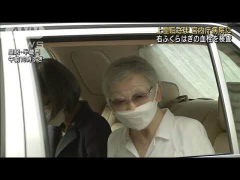 上皇后さま　宮内庁病院で検査　右ふくらはぎに血栓(2022年8月26日)