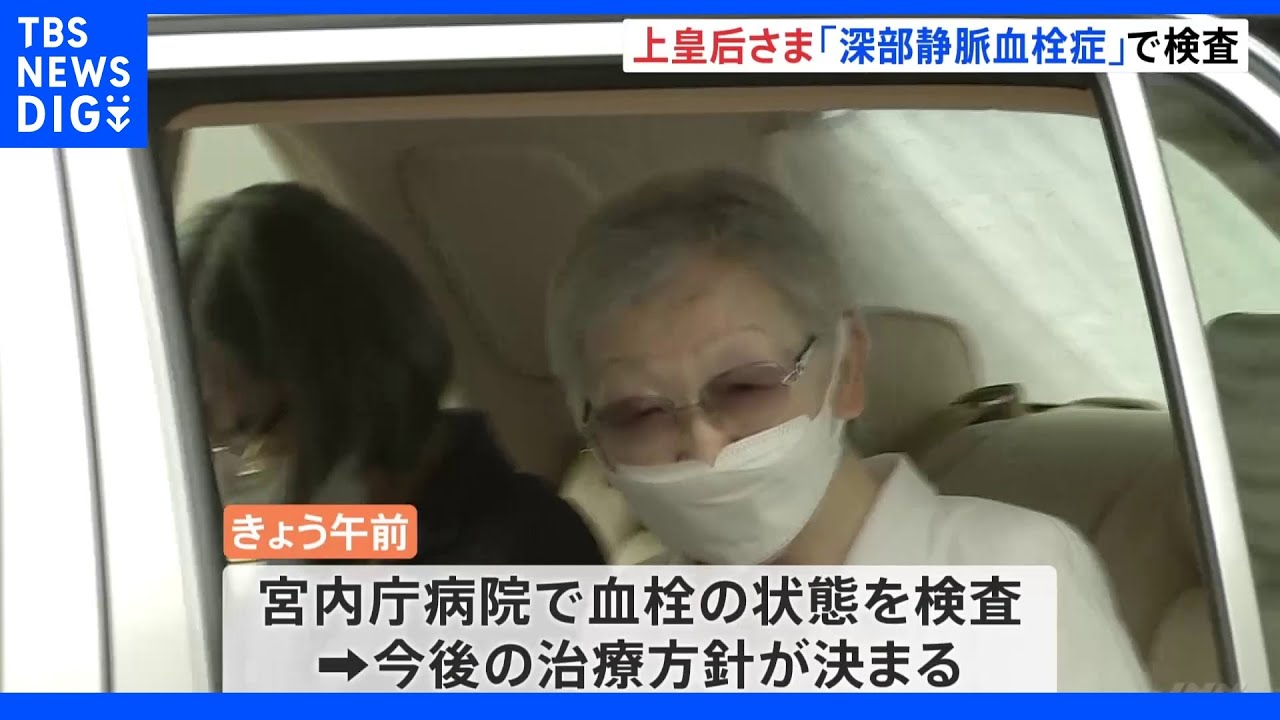 【速報】上皇后・美智子さま「深部静脈血栓症」と診断　宮内庁病院で検査｜TBS&nbsp;NEWS&nbsp;DIG