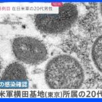 サル痘　国内3例目　東京・横田飛行場で米軍関係者の男性｜TBS NEWS DIG