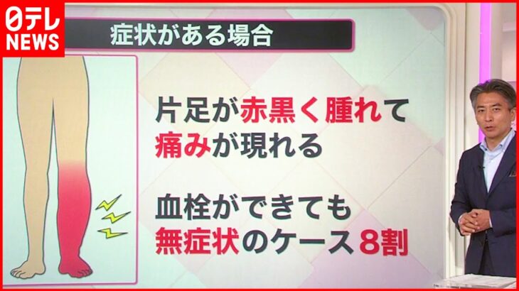 【解説】上皇后さま“血栓症”と診断 無症状「8割」若い人にもリスク？