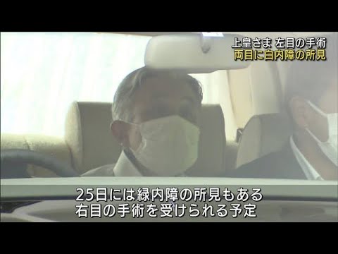 上皇さまが左目の手術　両目に白内障の所見(2022年9月19日)