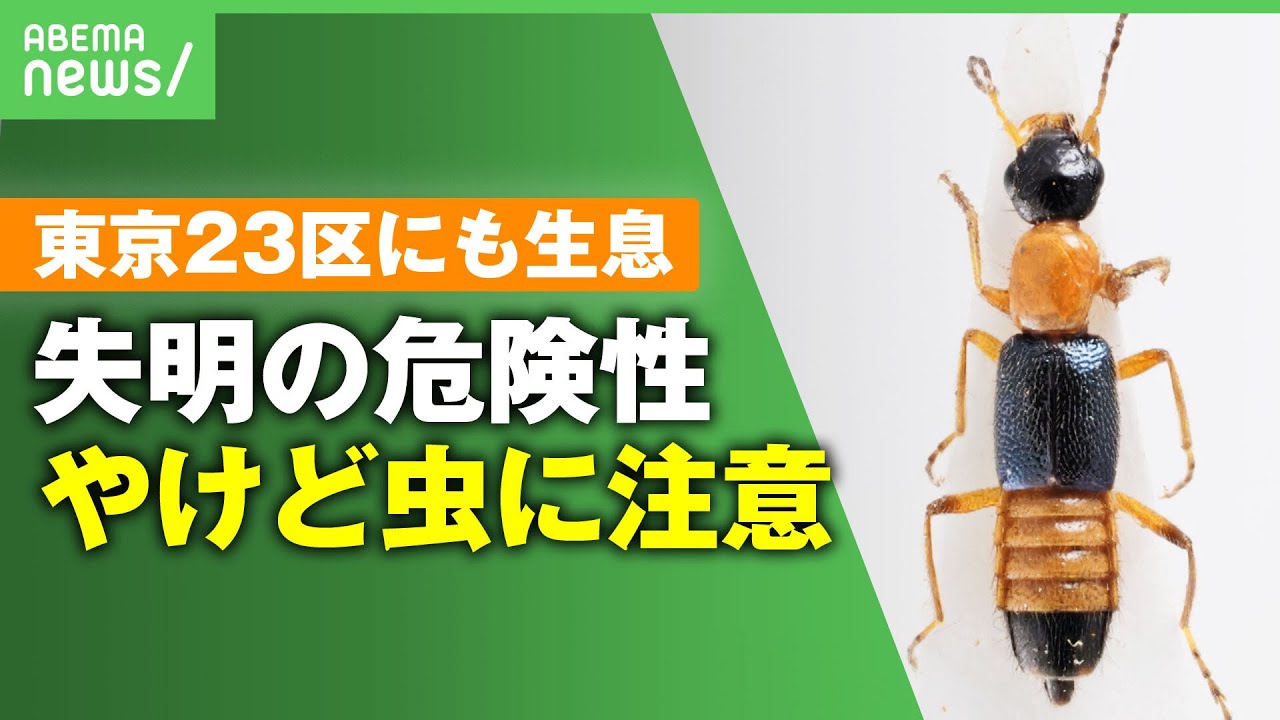 【やけど虫】体液に触れると失明？東京23区にも生息｢アオバアリガタハネカクシ｣とは…対策を聞く