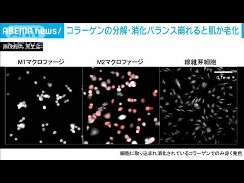 コラーゲン代謝に「マクロファージ」のバランス影響 資生堂が新たな研究結果発表(2022年9月16日)