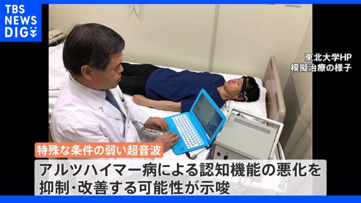 アルツハイマー病に新治療法の可能性 超音波を照射　副作用もない　東北大学が発表｜TBS NEWS DIG