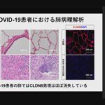 コロナが血管内に侵入するメカニズムを解明　重症化を防ぐ治療薬開発につながる期待　京大など