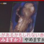 【NNNドキュメント】命の選択… 新型出生前診断で悩む妊婦の想い　NNNセレクション
