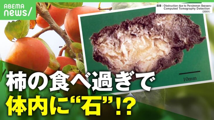 【注意】体内にできた5cmの「柿胃石」原因は”柿の食べ過ぎ”? 医師に聞く注意点