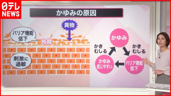 【解説】かゆみに“粉ふき”…ただの乾燥ではなく「皮脂欠乏症」 暖房との“距離”を意識