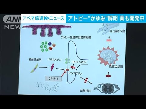 アトピーの“かゆみ原因”解明　薬も開発中(2023年1月11日)