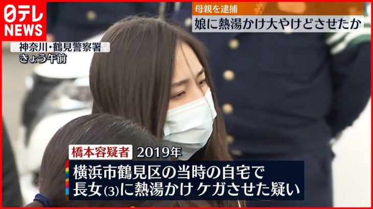 【母親を逮捕】長女に熱湯かけ大やけどをさせたか