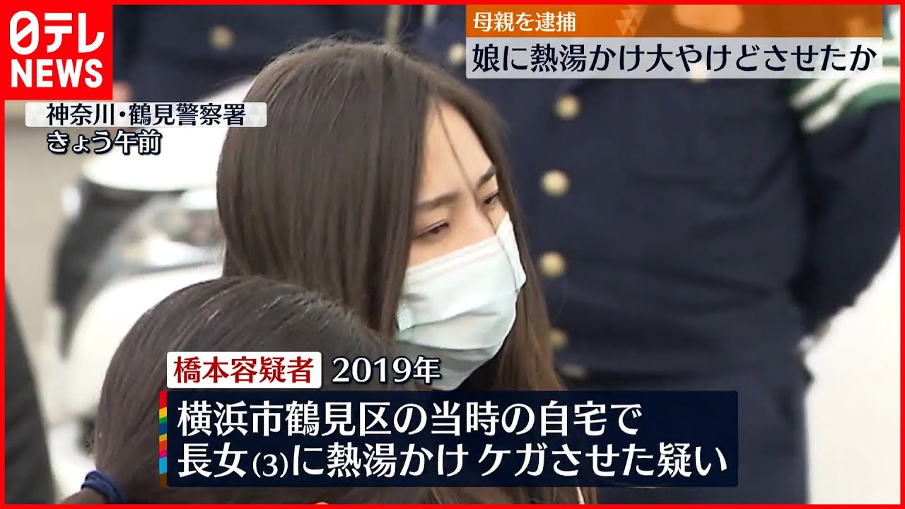 【母親を逮捕】長女に熱湯かけ大やけどをさせたか