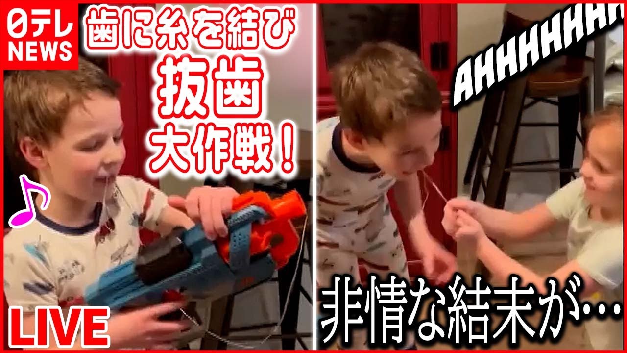 【世界衝撃ニュース】歯のグラグラが気になるお兄ちゃん　引き抜く作戦失敗も…　など　World Heart Stopping Moments（日テレNEWS LIVE）