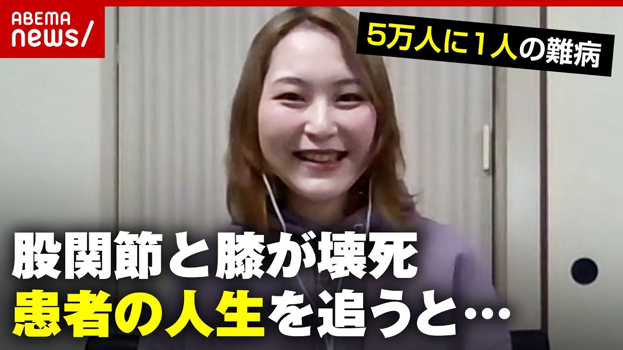 【難病】”5万人に1人”股関節と膝が壊死…女性患者のその後