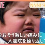 【Nドキュまとめ】難病と闘い続け…/顔面の”奇形”/13歳で余命宣告　命を見つめ生きる人々のドキュメンタリー