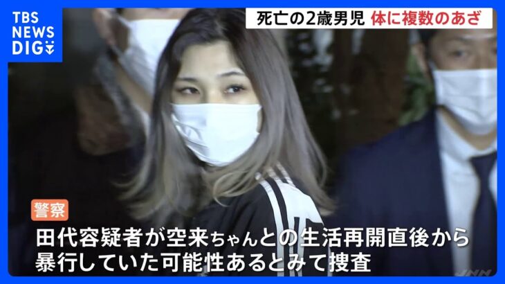 手や足に複数のあざ　暴行受け死亡の2歳児　逮捕の母親は同居再開後から暴行か　神奈川・藤沢市｜TBS NEWS DIG