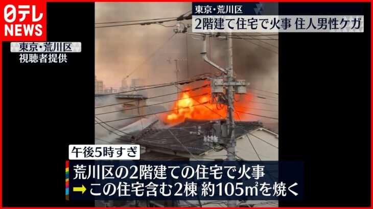 【火事】2階建て住宅で 住人の70代男性ケガ 東京・荒川区