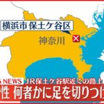 【速報】「すれ違った時に痛み」路上で足を切られる 横浜市