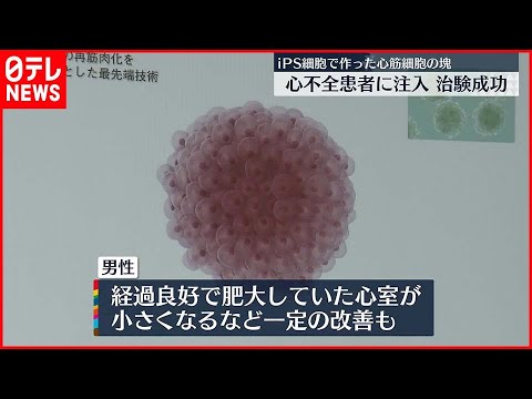 【世界初の治験に成功】iPS細胞から作った心筋細胞の塊を注入…　慶応大の福田教授らが発表