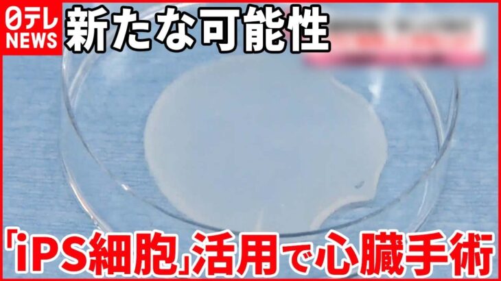 【手術現場を密着】九州大学病院「iPS細胞」活用 心臓病患者に新たな可能性