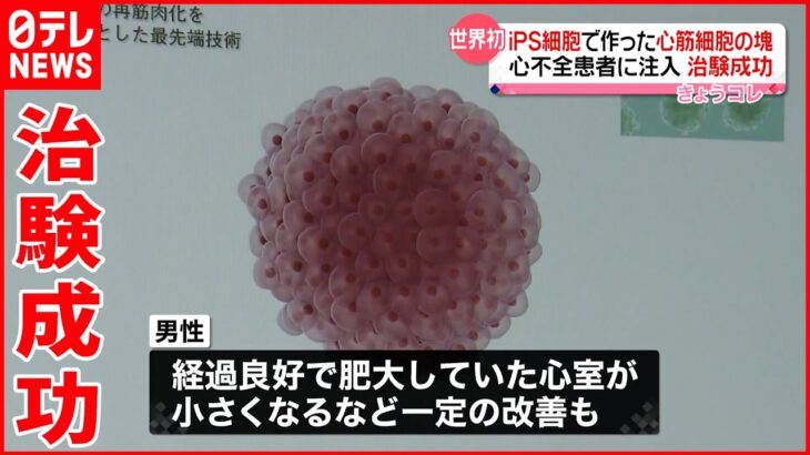 【世界初】iPS細胞から作った心筋細胞の塊を注入…治験成功