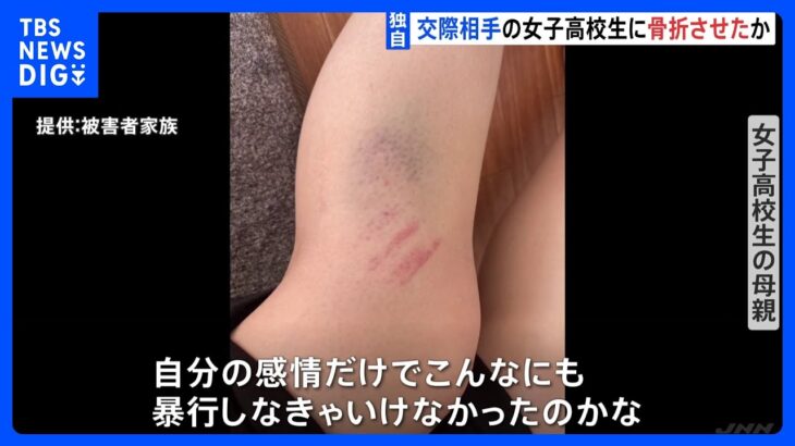 【独自】母親「心の傷深く、今も発作が」20歳の男が交際相手の女子高校生に6時間に及ぶ暴行　肋骨骨折などさせたか｜TBS NEWS DIG