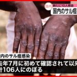 【国内のサル痘感染者】100人超える これまで全て男性…1月以来急増