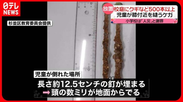 【校庭にクギなど500本以上放置】児童が膝付近を縫うケガ  校長は「人災」と謝罪  東京・杉並区