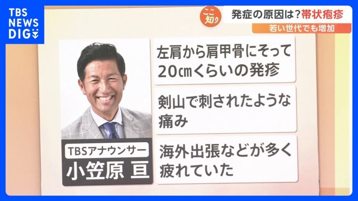 「二度とかかりたくない…」激痛で夜も眠れない“帯状疱疹” 50歳未満で発症率急増のワケとは？【Nスタ】｜TBS NEWS DIG