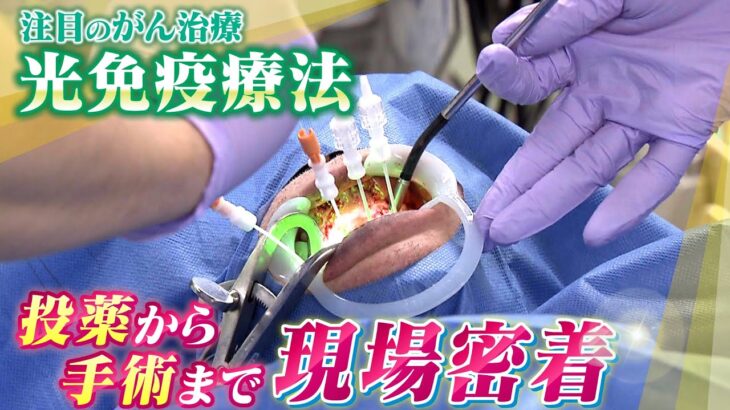 【注目のがん治療】がん手術で声帯摘出も経験した７７歳…新たに臨んだのは世界で初めて日本で承認『光免疫療法』　治療法開発の背景に「楽天・三木谷会長」と「日本人医師」の出会い（2023年5月18日）