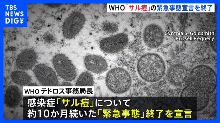 WHO「サル痘」の緊急事態宣言を終了｜TBS NEWS DIG