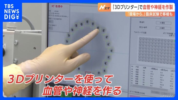 3Dプリンターで血管神経を作製臨床試験で移植も実施夢の治療法に迫るTBSNEWSDIG