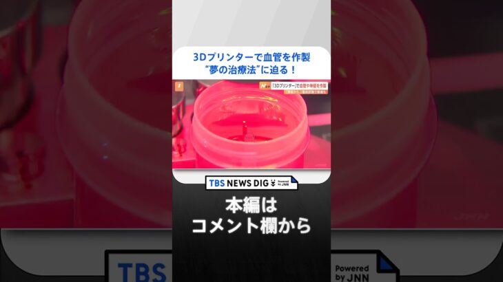 3Dプリンターで血管神経を作製臨床試験で移植も実施夢の治療法に迫るTBS NEWS DIG #shorts