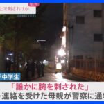 「誰かに腕を刺された」男子中学生が腕を刺され軽傷　30代くらい・180センチほどの人物が逃走　鹿児島市｜TBS NEWS DIG