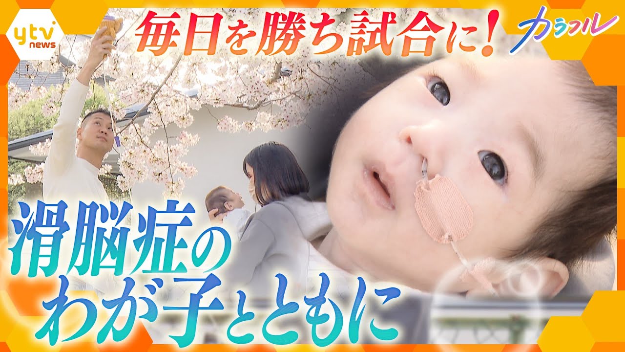 治療法のない難病滑脳症を患うわが子 覚悟はあるだけど信じるミオナは今のところ毎日勝ち試合やな共に戦う両親の日々かんさい情報ネットten.特集/カラフル