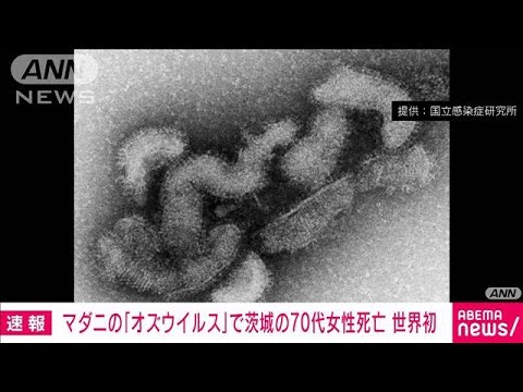 マダニが媒介するオズウイルスで女性が死亡ヒトへの感染確認は世界初(2023年6月23日)