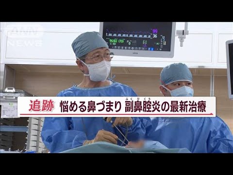 痛い手術…驚きの器具で進化 「副鼻腔炎」患者200万人　患者負担減らす最新“鼻”治療【Jの追跡】(2023年7月16日)