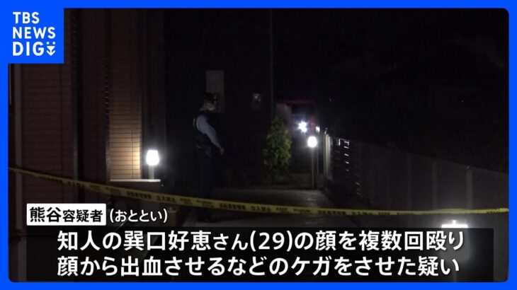 知人女性を殴り29歳女逮捕、殴られた女性は搬送先の病院で死亡確認　静岡・浜松市 ｜TBS NEWS DIG