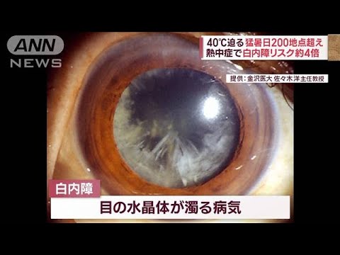 40℃迫る猛暑日200地点超え　熱中症で白内障リスク約4倍(2023年7月28日)