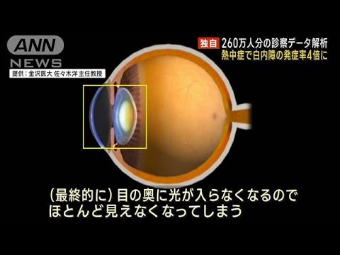 【独自】熱中症で白内障の発症率4倍に　260万人分の診察データ解析(2023年7月28日)