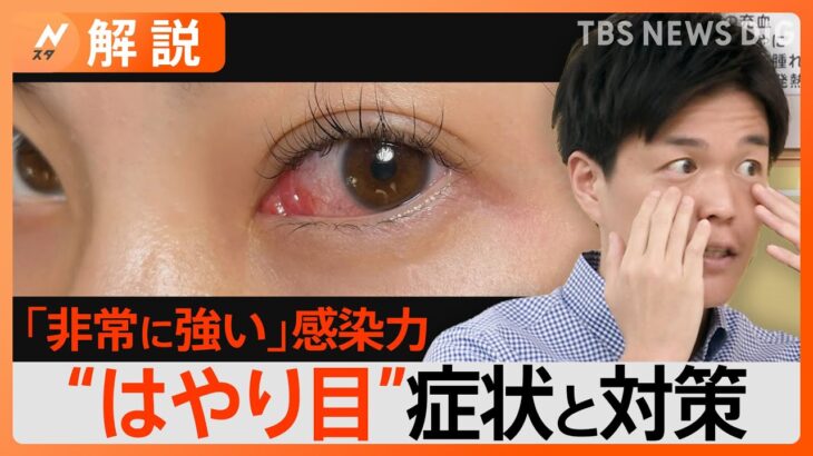 目の感染症“はやり目”に注意 1か月症状が治らない大人も…家庭内の“感染リレー”を防ぐポイントは？【Nスタ解説】｜TBS NEWS DIG