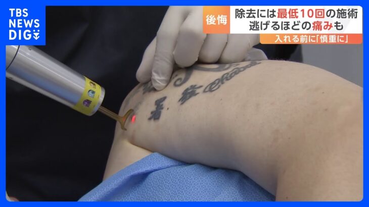 “痛みで逃げ出す人も” 韓国でタトゥー除去が増加　その背景に社会の変化 人口の4分の1がタトゥーを入れたとの推計｜TBS NEWS DIG