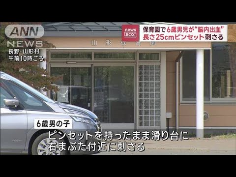 保育園で6歳男児が“脳内出血”　長さ25cmのピンセット刺さる(2023年10月20日)