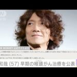 【THE YELLOW MONKEY】吉井和哉 早期の喉頭がん治療を公表「今年の年明けには根治」(2023年10月11日)