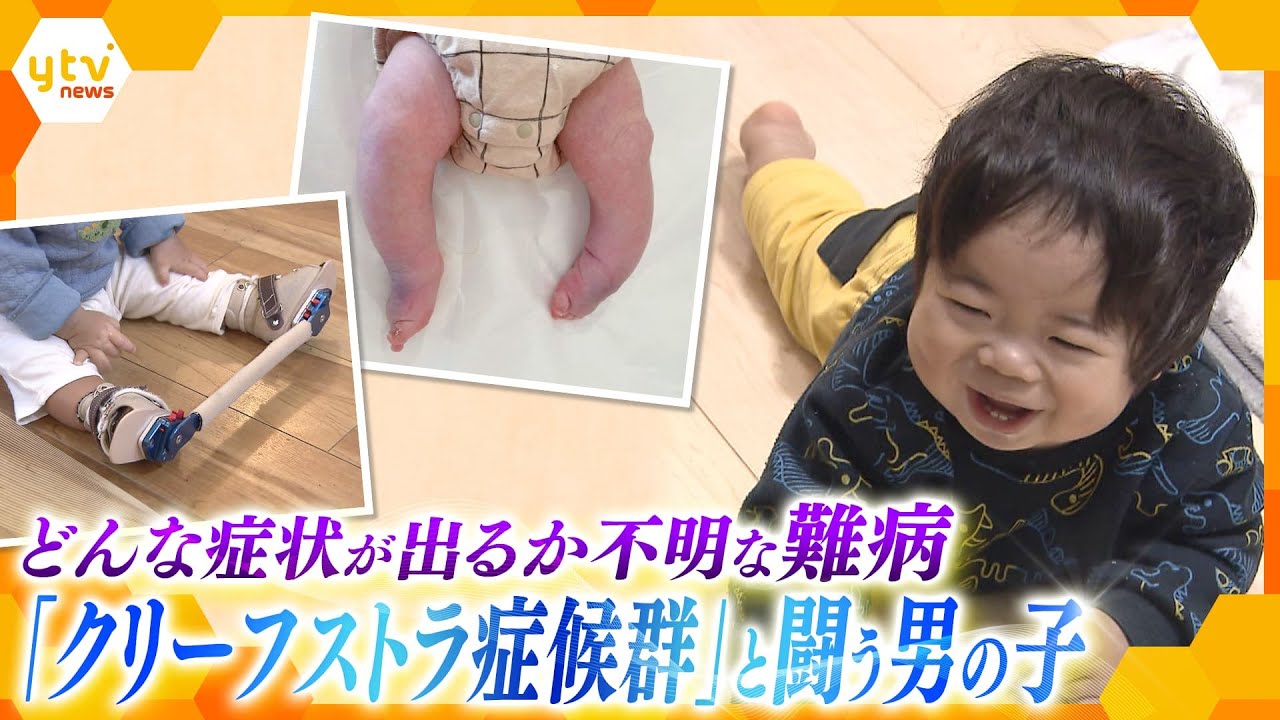 国内の患者はわずか100人…知られていないからこその困難「両親がいなくなったとしても助けてくれる社会があってほしい」 難病・クリーフストラ症候群と向き合う親子【かんさい情報ネット ten.特集】