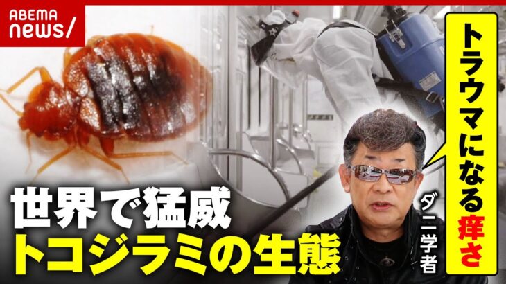 【世界で猛威】”トコジラミ”日本でも急増の懸念「殺虫剤への耐性も」「トラウマになる痒さ」｜ABEMA的ニュースショー