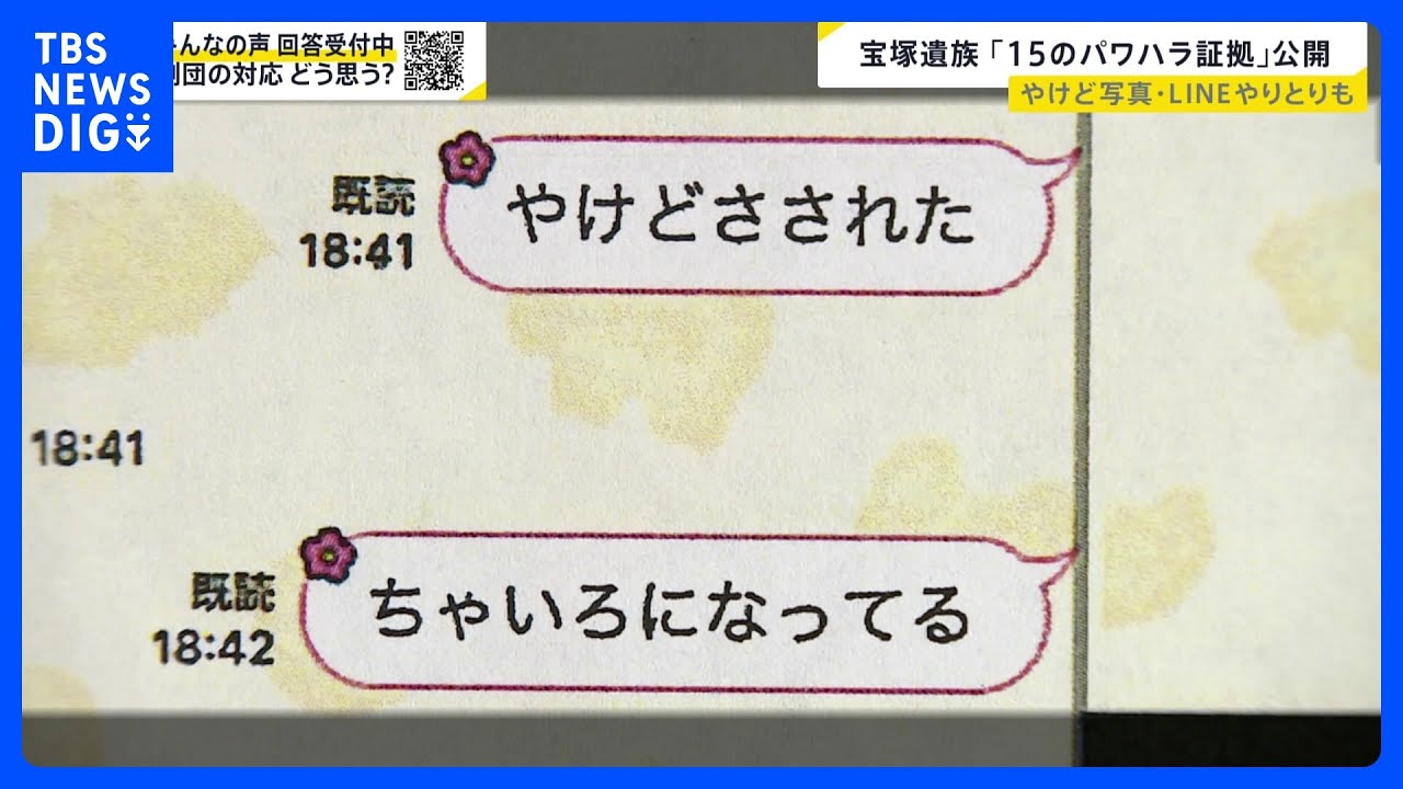 やけど写真やライン画面　宝塚歌劇団員の遺族が公開した“15のパワハラ行為”の証拠【news23】｜TBS&nbsp;NEWS&nbsp;DIG