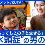 「この子を育てられない…」息子が“水頭症”と知って塞ぎ込んだ日々　「一生、この子と生きていく」と覚悟を決めたキッカケ【DIGドキュメント×KUTV】