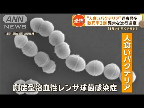 “人食いバクテリア”過去最多　致死率3割…「死を覚悟」片足失った男性　感染経路は【もっと知りたい！】【グッド！モーニング】(2024年1月22日)