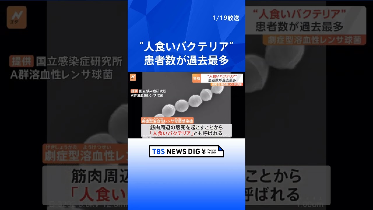 「人食いバクテリア」劇症型溶血性レンサ球菌感染症　去年の患者数が過去最多｜TBS NEWS DIG#shorts